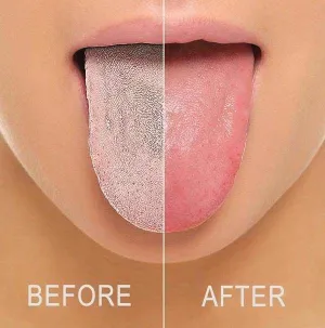 Tongue Scraper Cleaner